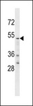 YTHDF2 Antibody - YTHD2 Antibody western blot of U251 cell line lysates (35 ug/lane). The YTHD2 antibody detected the YTHD2 protein (arrow).
