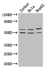 YTHDF2 Antibody - Western Blot Positive WB detected in: Jurkat whole cell lysate, Hela whole cell lysate, HepG2 whole cell lysate All lanes: YTHDF2 antibody at 2.7µg/ml Secondary Goat polyclonal to rabbit IgG at 1/50000 dilution Predicted band size: 63, 57 kDa Observed band size: 63, 50 kDa