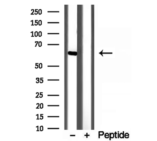 YTHDF2 Antibody - Western blot analysis of extracts of L02 cells using YTHDF2 antibody.