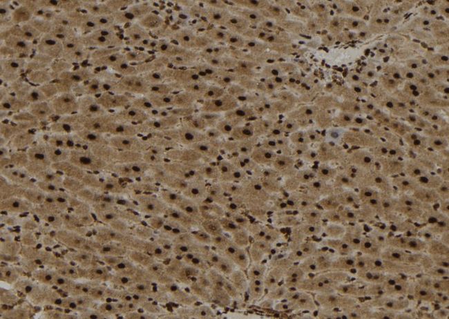YTHDF2 Antibody - 1:100 staining mouse liver tissue by IHC-P. The sample was formaldehyde fixed and a heat mediated antigen retrieval step in citrate buffer was performed. The sample was then blocked and incubated with the antibody for 1.5 hours at 22°C. An HRP conjugated goat anti-rabbit antibody was used as the secondary.