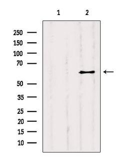 YTHDF2 Antibody - Western blot analysis of extracts of B16F10 cells using YTHDF2 antibody. Lane 1 was treated with the blocking peptide.