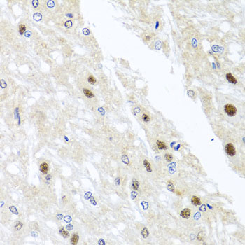 YTHDF3 Antibody - Immunohistochemistry of paraffin-embedded rat brain tissue.