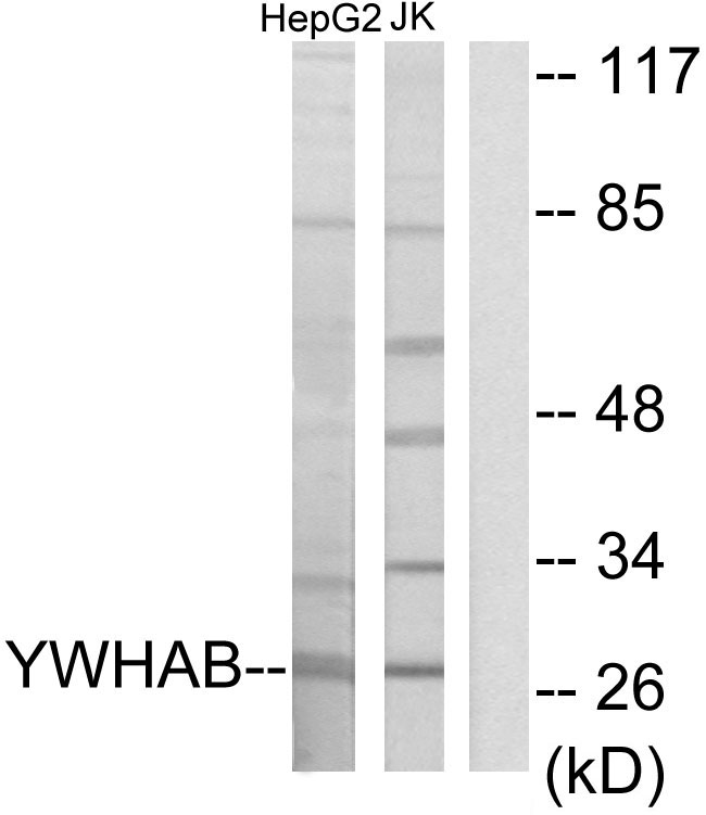 YWHAB / 14-3-3 Beta Antibody - Western blot analysis of lysates from HepG2 and Jurkat cells, using 14-3-3 beta Antibody. The lane on the right is blocked with the synthesized peptide.