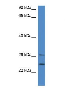 YWHAB / 14-3-3 Beta Antibody - YWHAB / 14-3-3 Beta antibody Western blot of Fetal Brain lysate. Antibody concentration 1 ug/ml. This image was taken for the unconjugated form of this product. Other forms have not been tested.