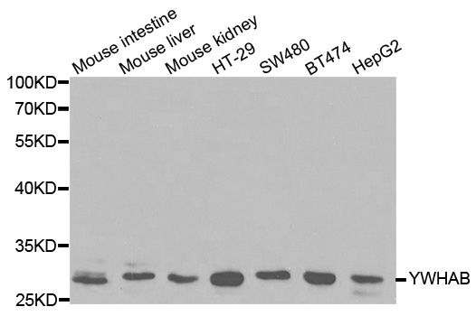 YWHAB / 14-3-3 Beta Antibody - Western blot analysis of extracts of various cell lines, using YWHAB antibody at 1:1000 dilution. The secondary antibody used was an HRP Goat Anti-Rabbit IgG (H+L) at 1:10000 dilution. Lysates were loaded 25ug per lane and 3% nonfat dry milk in TBST was used for blocking.