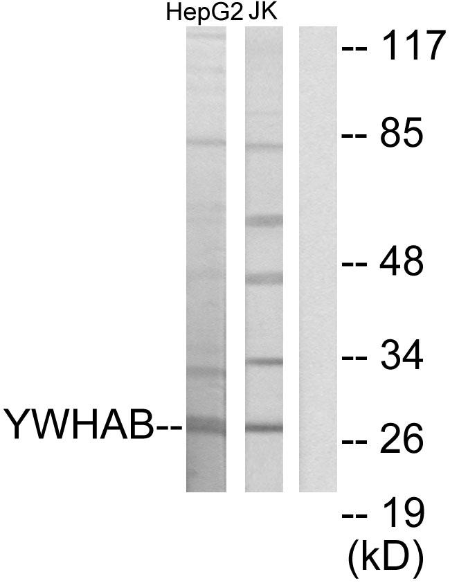 YWHAB / 14-3-3 Beta Antibody - Western blot analysis of extracts from HepG2 cells and Jurkat cells, using 14-3-3 ß antibody.