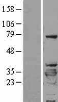 YWHAB / 14-3-3 Beta Protein - Western validation with an anti-DDK antibody * L: Control HEK293 lysate R: Over-expression lysate