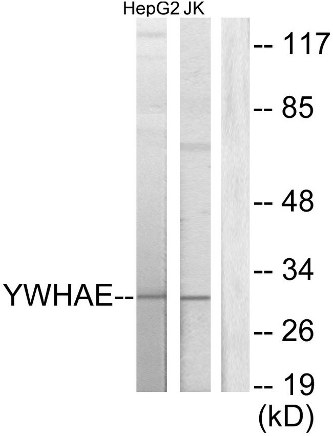 YWHAE / 14-3-3 Epsilon Antibody - Western blot analysis of lysates from HepG2 and Jurkat cells, using 14-3-3 epsilon Antibody. The lane on the right is blocked with the synthesized peptide.