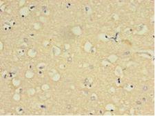 YWHAE / 14-3-3 Epsilon Antibody - Immunohistochemistry of paraffin-embedded human brain tissue using antibody at 1:100 dilution.  This image was taken for the unconjugated form of this product. Other forms have not been tested.