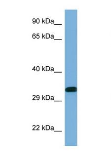 YWHAE / 14-3-3 Epsilon Antibody - YWHAE / 14-3-3 Epsilon antibody Western blot of Placenta lysate. Antibody concentration 1 ug/ml.  This image was taken for the unconjugated form of this product. Other forms have not been tested.