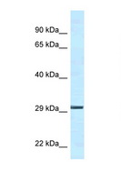 YWHAE / 14-3-3 Epsilon Antibody - YWHAE / 14-3-3 Epsilon antibody Western blot of Mouse Kidney lysate. Antibody concentration 1 ug/ml.  This image was taken for the unconjugated form of this product. Other forms have not been tested.