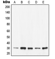YWHAE / 14-3-3 Epsilon Antibody - Western blot analysis of 14-3-3 epsilon expression in KNRK (A); SW480 (B); Caco2 (C); NIH3T3 (D); H9C2 (E) whole cell lysates.