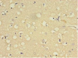 YWHAE / 14-3-3 Epsilon Antibody - Immunohistochemistry of paraffin-embedded human brain tissue using antibody at 1:100 dilution.  This image was taken for the unconjugated form of this product. Other forms have not been tested.