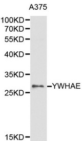 YWHAE / 14-3-3 Epsilon Antibody - Western blot of YWHAE pAb in extracts from A375 cells.