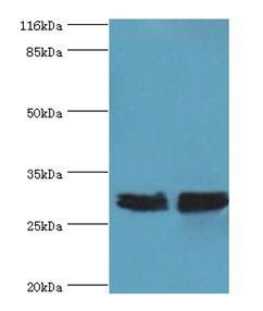 YWHAE / 14-3-3 Epsilon Antibody - Western blot. All lanes: YWHAE antibody at 2 ug/ml. Lane 1: HeLa whole cell lysate Lane 2: mouse brain tissue. Secondary antibody: goat polyclonal to rabbit at 1:10000 dilution. Predicted band size: 29 kDa. Observed band size: 29 kDa.  This image was taken for the unconjugated form of this product. Other forms have not been tested.