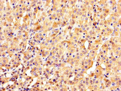 YWHAE / 14-3-3 Epsilon Antibody - IHC image of YWHAE Antibody diluted at 1:1000 and staining in paraffin-embedded human adrenal gland tissue performed on a Leica BondTM system. After dewaxing and hydration, antigen retrieval was mediated by high pressure in a citrate buffer (pH 6.0). Section was blocked with 10% normal goat serum 30min at RT. Then primary antibody (1% BSA) was incubated at 4°C overnight. The primary is detected by a biotinylated secondary antibody and visualized using an HRP conjugated SP system.