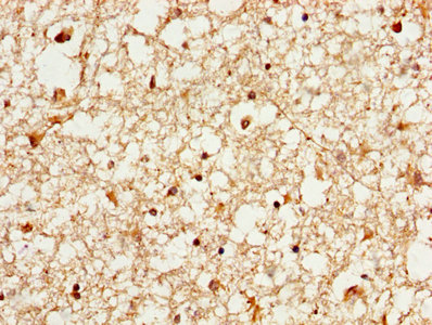 YWHAE / 14-3-3 Epsilon Antibody - IHC image of YWHAE Antibody diluted at 1:1000 and staining in paraffin-embedded human brain tissue performed on a Leica BondTM system. After dewaxing and hydration, antigen retrieval was mediated by high pressure in a citrate buffer (pH 6.0). Section was blocked with 10% normal goat serum 30min at RT. Then primary antibody (1% BSA) was incubated at 4°C overnight. The primary is detected by a biotinylated secondary antibody and visualized using an HRP conjugated SP system.