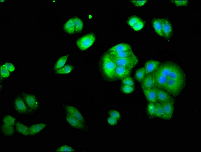 YWHAE / 14-3-3 Epsilon Antibody - Immunofluorescence staining of HepG2 cells with YWHAE Antibody at 1:333, counter-stained with DAPI. The cells were fixed in 4% formaldehyde, permeabilized using 0.2% Triton X-100 and blocked in 10% normal Goat Serum. The cells were then incubated with the antibody overnight at 4°C. The secondary antibody was Alexa Fluor 488-congugated AffiniPure Goat Anti-Rabbit IgG(H+L).