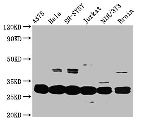 YWHAE / 14-3-3 Epsilon Antibody - Western Blot Positive WB detected in: A375 whole cell lysate, Hela whole cell lysate, SH-SY5Y whole cell lysate, Jurkat whole cell lysate, NIH/3T3 whole cell lysate, Mouse brain tissue All lanes: YWHAE antibody at 3.3µg/ml Secondary Goat polyclonal to rabbit IgG at 1/50000 dilution Predicted band size: 30, 27 kDa Observed band size: 30 kDa