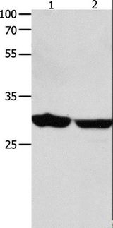 YWHAE / 14-3-3 Epsilon Antibody - Western blot analysis of Human brain malignant glioma and laryngocarcinoma tissue, using YWHAE Polyclonal Antibody at dilution of 1:1300.