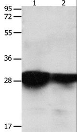 YWHAE / 14-3-3 Epsilon Antibody - Western blot analysis of Human brain malignant glioma and laryngocarcinoma tissue, using YWHAE Polyclonal Antibody at dilution of 1:2200.
