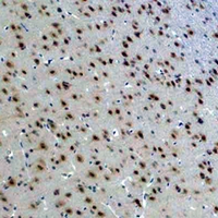 YWHAE / 14-3-3 Epsilon Antibody - Immunohistochemical analysis of 14-3-3 epsilon staining in rat brain formalin fixed paraffin embedded tissue section. The section was pre-treated using heat mediated antigen retrieval with sodium citrate buffer (pH 6.0). The section was then incubated with the antibody at room temperature and detected using an HRP conjugated compact polymer system. DAB was used as the chromogen. The section was then counterstained with hematoxylin and mounted with DPX.