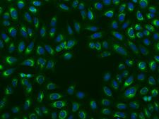 YWHAE / 14-3-3 Epsilon Antibody - Immunofluorescence staining of YWHAE in U2OS cells. Cells were fixed with 4% PFA, permeabilzed with 0.1% Triton X-100 in PBS, blocked with 10% serum, and incubated with rabbit anti-Human YWHAE polyclonal antibody (dilution ratio 1:200) at 4°C overnight. Then cells were stained with the Alexa Fluor 488-conjugated Goat Anti-rabbit IgG secondary antibody (green) and counterstained with DAPI (blue). Positive staining was localized to Cytoplasm.
