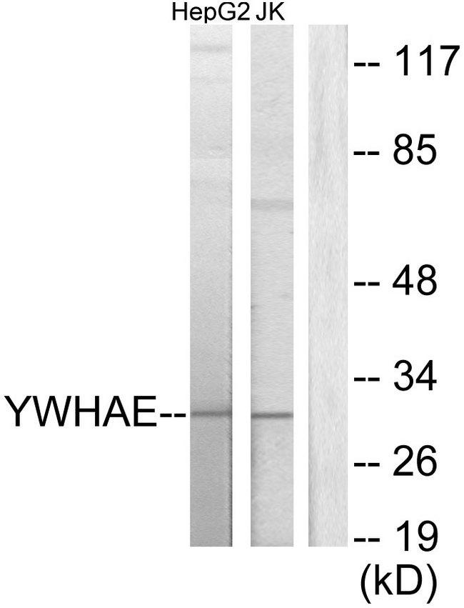 YWHAE / 14-3-3 Epsilon Antibody - Western blot analysis of extracts from HepG2 cells and Jurkat cells, using 14-3-3 e antibody.