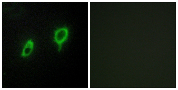 YWHAG / 14-3-3 Gamma Antibody - Immunofluorescence analysis of COS7 cells, using 14-3-3 gamma Antibody. The picture on the right is blocked with the synthesized peptide.