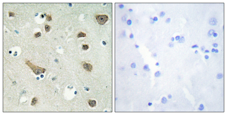 YWHAG / 14-3-3 Gamma Antibody - Immunohistochemistry analysis of paraffin-embedded human brain tissue, using 14-3-3 gamma Antibody. The picture on the right is blocked with the synthesized peptide.