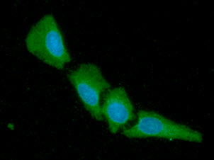 YWHAG / 14-3-3 Gamma Antibody - ICC/IF analysis of 14-3-3 gamma in HeLa cells line, stained with DAPI (Blue) for nucleus staining and monoclonal anti-human 14-3-3 gamma antibody (1:100) with goat anti-mouse IgG-Alexa fluor 488 conjugate (Green).