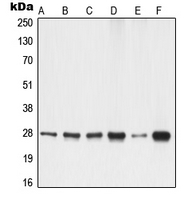 YWHAG / 14-3-3 Gamma Antibody - Western blot analysis of 14-3-3 gamma expression in A549 (A); A431 (B); K562 (C); NIH3T3 (D); PC12 (E); rat liver (F) whole cell lysates.