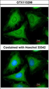 YWHAG / 14-3-3 Gamma Antibody - Immunofluorescence of methanol-fixed HeLa, using 14-3-3 gamma antibody at 1:200 dilution.
