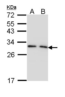 YWHAG / 14-3-3 Gamma Antibody - Sample (30 ug of whole cell lysate). A: 293T. B: A431. 12% SDS PAGE. YWHAG antibody diluted at 1:1000. 