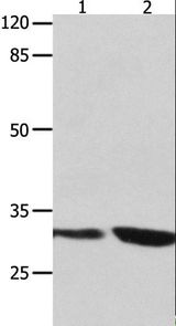 YWHAG / 14-3-3 Gamma Antibody - Western blot analysis of 293T and Jurkat cell, using YWHAG Polyclonal Antibody at dilution of 1:800.