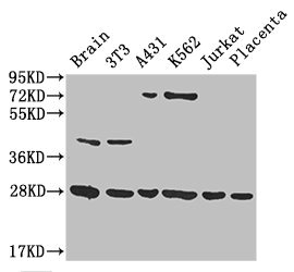 YWHAG / 14-3-3 Gamma Antibody - Western Blot Positive WB detected in:mouse brain tissue,NIH/3T3 whole cell lysate,A431 whole cell lysate,K562 whole cell lysate,Jurkat whole cell lysate,human placenta tissue All Lanes: YWHAG antibody at 3.4ug/ml Secondary Goat polyclonal to rabbit IgG at 1/50000 dilution Predicted band size: 28 kDa Observed band size: 28,45,72 kDa