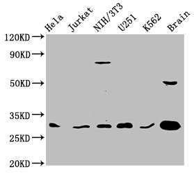 YWHAG / 14-3-3 Gamma Antibody - Western Blot Positive WB detected in: Hela whole cell lysate, Jurkat whole cell lysate, NIH/3T3 whole cell lysate, U251 whole cell lysate, K562 whole cell lysate, Rat brain tissue All lanes: YWHAG antibody at 3.3µg/ml Secondary Goat polyclonal to rabbit IgG at 1/50000 dilution Predicted band size: 29 kDa Observed band size: 29 kDa