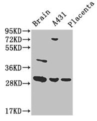 YWHAG / 14-3-3 Gamma Antibody - Western Blot Positive WB detected in: Mouse brain tissue, A431 whole cell lysate, Human placenta tissue All lanes: YWHAG antibody at 3.4µg/ml Secondary Goat polyclonal to rabbit IgG at 1/50000 dilution Predicted band size: 29 kDa Observed band size: 29 kDa