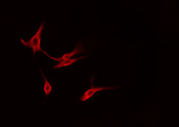 YWHAG / 14-3-3 Gamma Antibody - Staining HeLa cells by IF/ICC. The samples were fixed with PFA and permeabilized in 0.1% Triton X-100, then blocked in 10% serum for 45 min at 25°C. The primary antibody was diluted at 1:200 and incubated with the sample for 1 hour at 37°C. An Alexa Fluor 594 conjugated goat anti-rabbit IgG (H+L) antibody, diluted at 1/600, was used as secondary antibody.