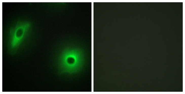 YWHAH / 14-3-3 Eta Antibody - Immunofluorescence analysis of HeLa cells, using 14-3-3 eta Antibody. The picture on the right is blocked with the synthesized peptide.