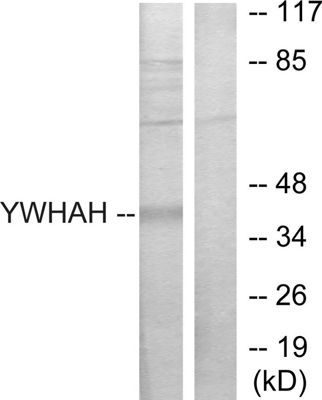 YWHAH / 14-3-3 Eta Antibody - Western blot analysis of lysates from Jurkat cells, using 14-3-3 eta Antibody. The lane on the right is blocked with the synthesized peptide.