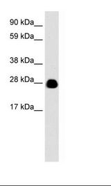 YWHAH / 14-3-3 Eta Antibody - Fetal Brain Lysate.  This image was taken for the unconjugated form of this product. Other forms have not been tested.