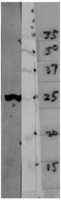 YWHAH / 14-3-3 Eta Antibody - Western blot of crude HeLa cell homogenate blotted with 14-3-3 eta Antibody (left lane) and various molecular weight standards (right lane - numbers indicate apparent SDS-PAGE molecular weight in kDa). The 14-3-3 eta (3G12) monoclonal binds strongly and cleanly to a band at about 28kDa.