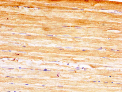 YWHAH / 14-3-3 Eta Antibody - IHC image of YWHAH Antibody diluted at 1:400 and staining in paraffin-embedded human skeletal muscle tissue performed on a Leica BondTM system. After dewaxing and hydration, antigen retrieval was mediated by high pressure in a citrate buffer (pH 6.0). Section was blocked with 10% normal goat serum 30min at RT. Then primary antibody (1% BSA) was incubated at 4°C overnight. The primary is detected by a biotinylated secondary antibody and visualized using an HRP conjugated SP system.