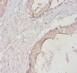 YWHAH / 14-3-3 Eta Antibody - Immunohistochemistry of paraffin-embedded human prostate tissue using YWHAH Antibody at dilution of 1:20