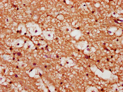 YWHAQ / 14-3-3 Theta Antibody - IHC image of YWHAQ Antibody diluted at 1:173 and staining in paraffin-embedded human brain tissue performed on a Leica BondTM system. After dewaxing and hydration, antigen retrieval was mediated by high pressure in a citrate buffer (pH 6.0). Section was blocked with 10% normal goat serum 30min at RT. Then primary antibody (1% BSA) was incubated at 4°C overnight. The primary is detected by a biotinylated secondary antibody and visualized using an HRP conjugated SP system.