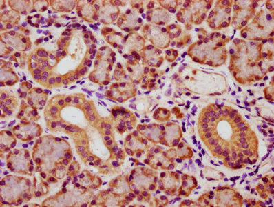 YWHAQ / 14-3-3 Theta Antibody - IHC image of YWHAQ Antibody diluted at 1:173 and staining in paraffin-embedded human pancreatic tissue performed on a Leica BondTM system. After dewaxing and hydration, antigen retrieval was mediated by high pressure in a citrate buffer (pH 6.0). Section was blocked with 10% normal goat serum 30min at RT. Then primary antibody (1% BSA) was incubated at 4°C overnight. The primary is detected by a biotinylated secondary antibody and visualized using an HRP conjugated SP system.