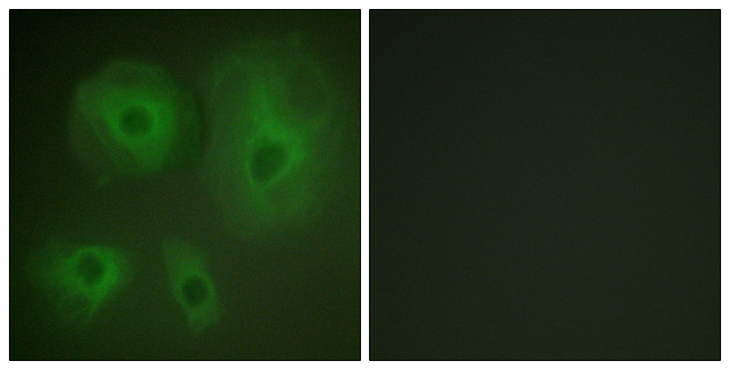 YWHAQ / 14-3-3 Theta Antibody - Immunofluorescence analysis of HeLa cells, using 14-3-3 thet/tau Antibody. The picture on the right is blocked with the synthesized peptide.