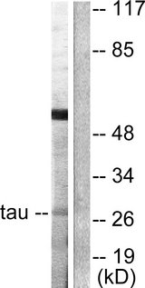 YWHAQ / 14-3-3 Theta Antibody - Western blot analysis of lysates from HeLa cells, using 14-3-3 thet/tau Antibody. The lane on the right is blocked with the synthesized peptide.