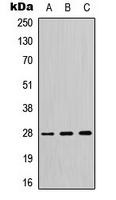YWHAQ / 14-3-3 Theta Antibody - Western blot analysis of 14-3-3 theta/tau expression in HeLa (A); SP2/0 (B); H9C2 (C) whole cell lysates.